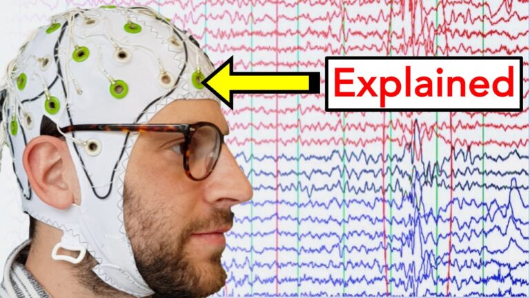 How EEG Works: Unlocking Mysteries Of The Mind