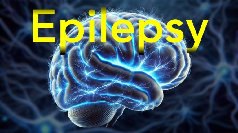 The Truth About Epilepsy: Understanding This Brain Condition