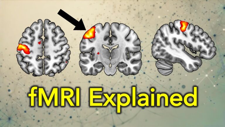 The Best Undergraduate Explanation of Functional MRI